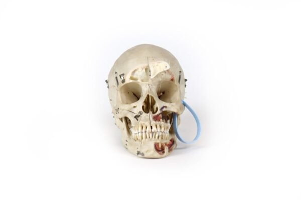 Demonstrative Skull (0186)