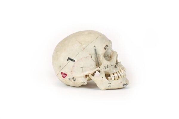 Demonstrative Skull (0186) - Image 3