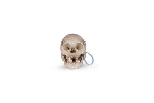 Clay Adams Medical Skull (0201) 