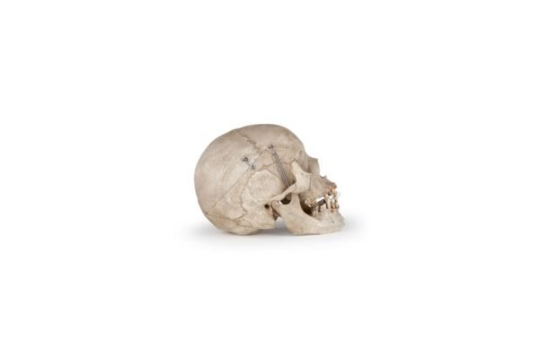 Clay Adams Medical Skull (0201)  - Image 2