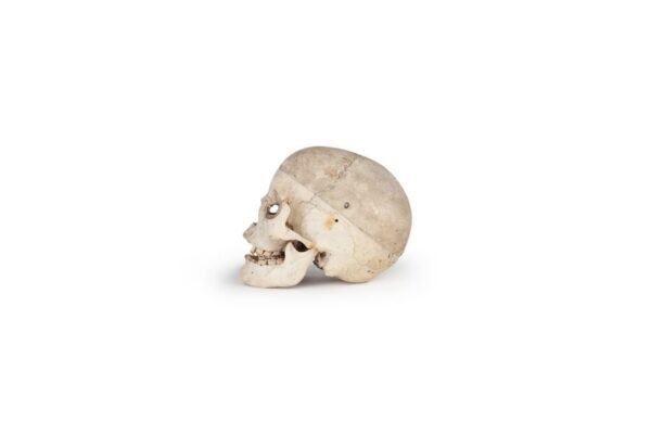 Medical Skull (0164) - Image 2