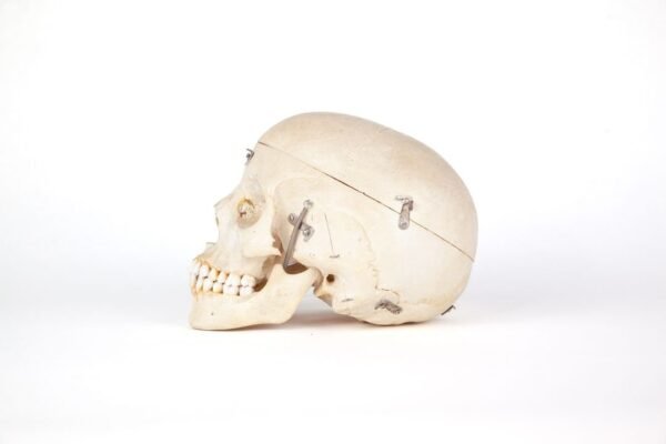 Medical Skull (0206) - Image 2