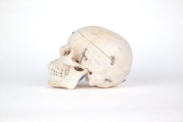 Medical Skull (0207) - Image 2