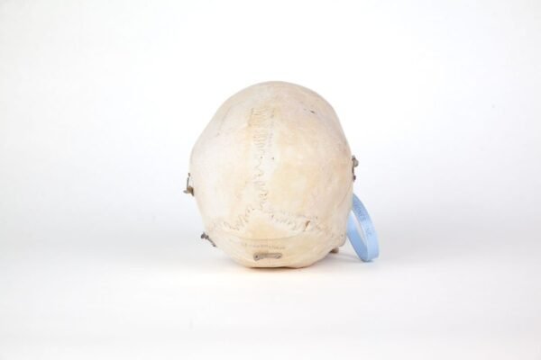 Medical Skull (0207) - Image 4