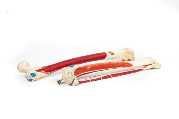 Femur Tibia & Fibula Articulation (004)