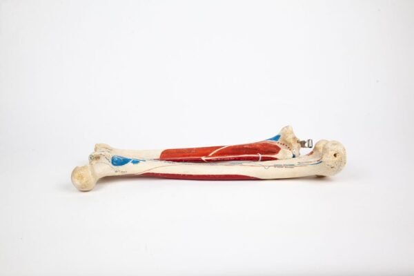 Femur Tibia & Fibula Articulation (004) - Image 3