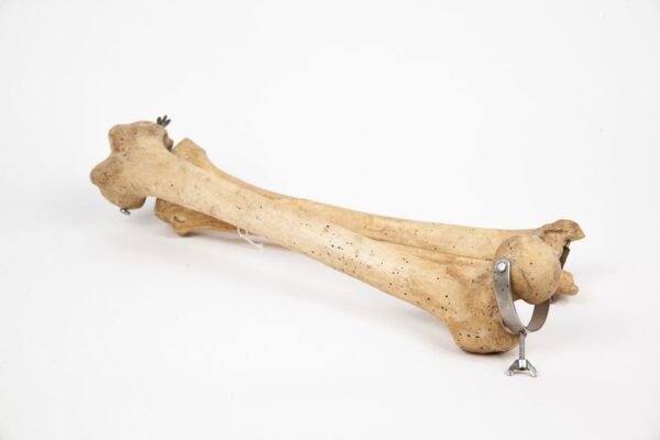 Femur Tibia & Fibula Articulation (005) - Image 4