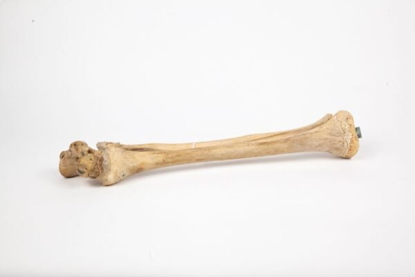 Tibia & Fibula Articulation (007) - Image 2