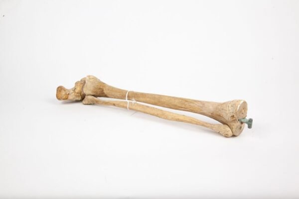 Tibia & Fibula Articulation (007) - Image 3