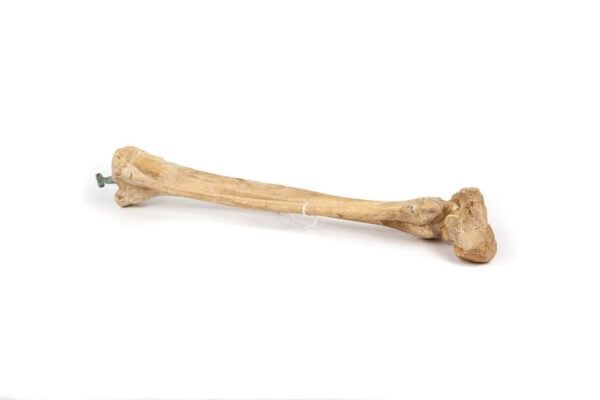 Tibia & Fibula Articulation (007)
