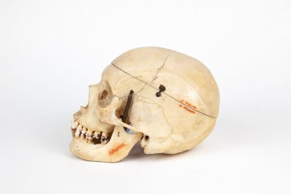 Medical Skull (0219) - Image 2