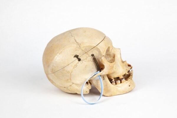 Medical Skull (0219) - Image 3