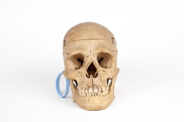 Vasseur-Tramond Medical Skull (0220)