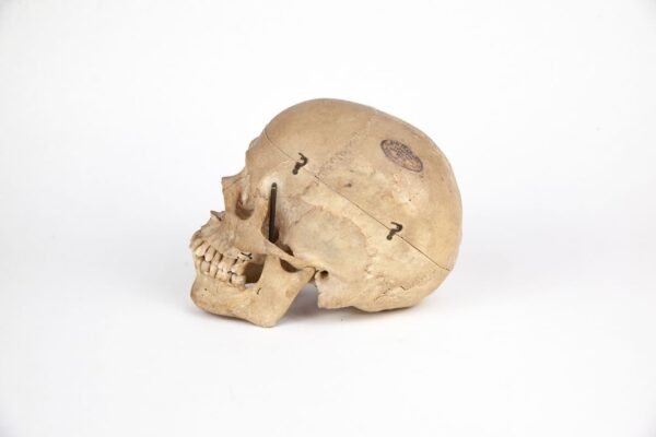 Vasseur-Tramond Medical Skull (0220) - Image 3