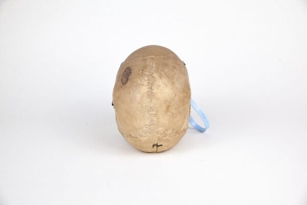 Vasseur-Tramond Medical Skull (0220) - Image 4