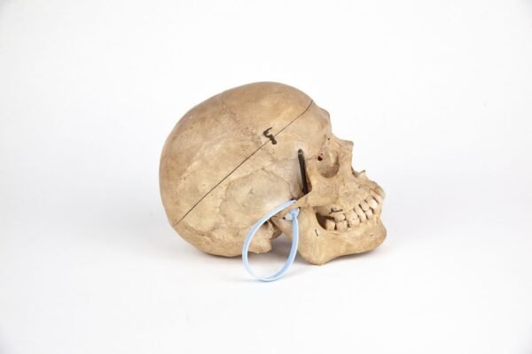 Vasseur-Tramond Medical Skull (0220) - Image 2