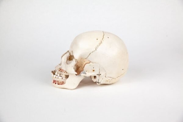 Disarticulated Skull (0224) - Image 3