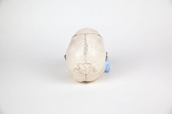 Medical Skull (0227) - Image 4