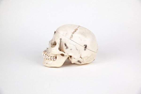 Medical Skull (0227) - Image 3