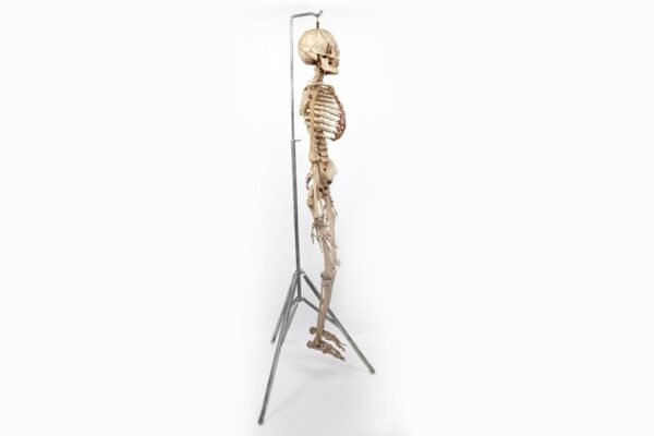 Antique Adam, Rouilly Articulated Skeleton (0923) - Image 5