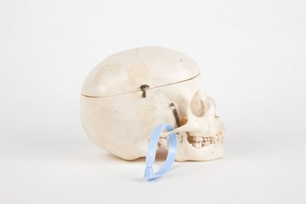 Pediatric Skull (0211) - Image 3