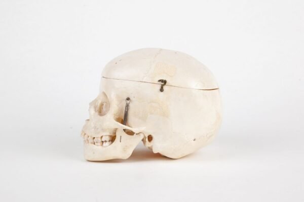 Pediatric Skull (0211) - Image 2