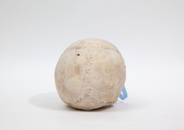 Trepanned Medical Skull (0228) - Image 4