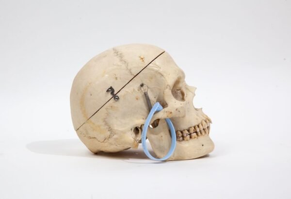 Medical Skull (0232) - Image 3