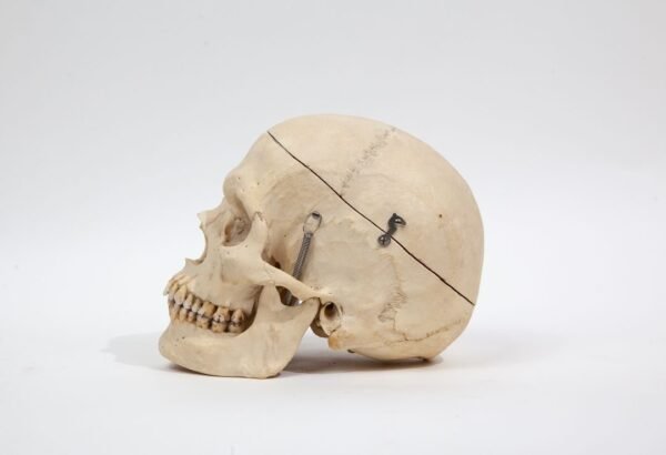 Medical Skull (0232) - Image 2