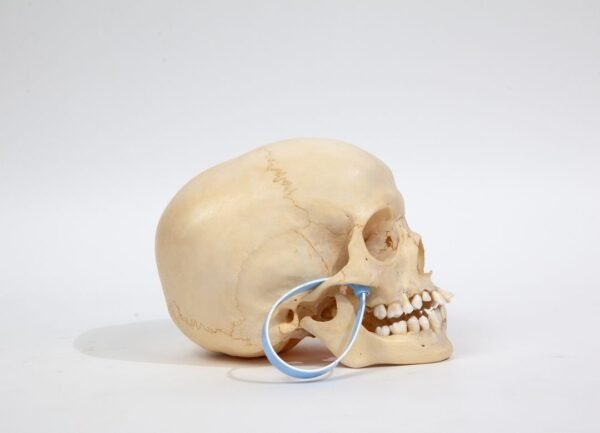 Kilgore Pediatric Skull (0233) - Image 2