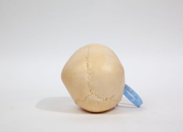 Kilgore Pediatric Skull (0233) - Image 4