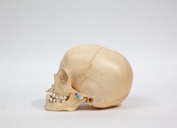 Kilgore Pediatric Skull (0233) - Image 3