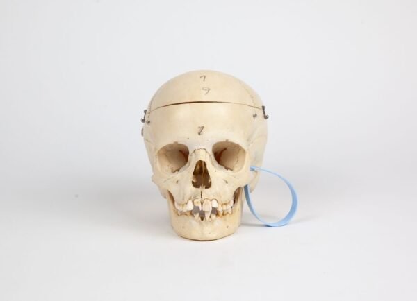Pediatric Skull (0238)