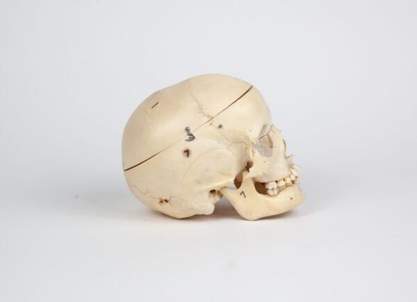 Pediatric Skull (0238) - Image 2