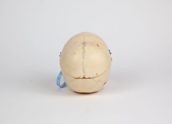Pediatric Skull (0238) - Image 4
