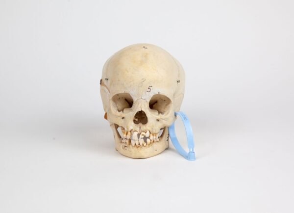 Pediatric Skull (0240)
