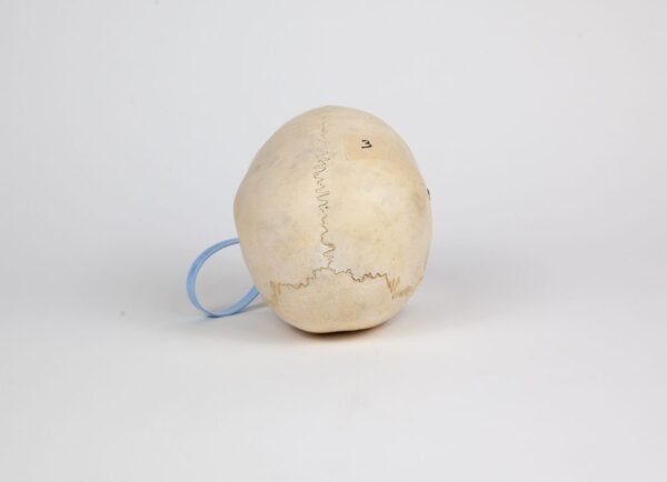 Pediatric Skull (0240) - Image 4