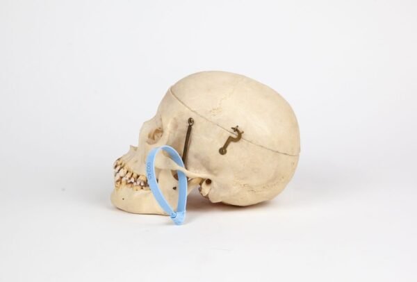 Half-Skeleton Bone Box (0245) - Image 6