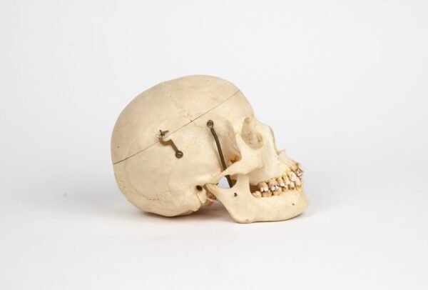 Half-Skeleton Bone Box (0245) - Image 7