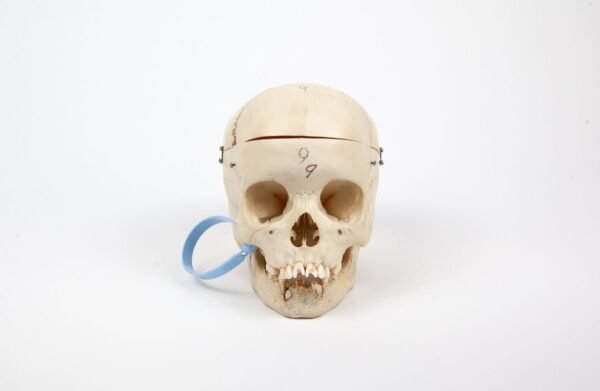 Pediatric Skull (0239)