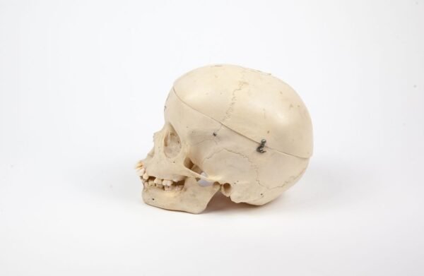 Pediatric Skull (0239) - Image 3
