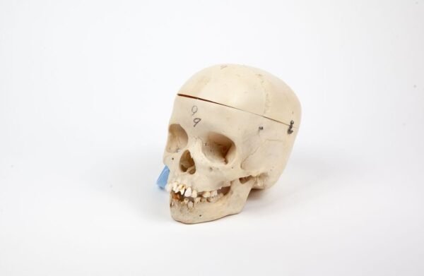 Pediatric Skull (0239) - Image 2