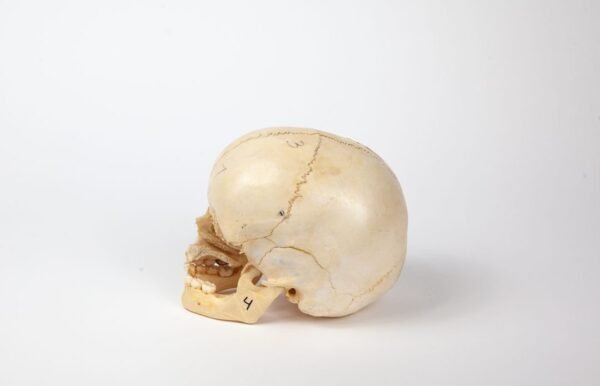 Uncut Pediatric Skull (0241) - Image 3
