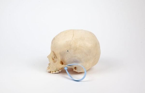 Uncut Pediatric Skull (0248) - Image 3