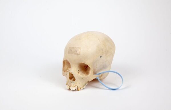 Uncut Pediatric Skull (0248) - Image 2