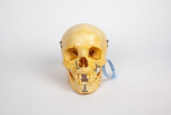 Skull with Facial Reconstruction (0249)