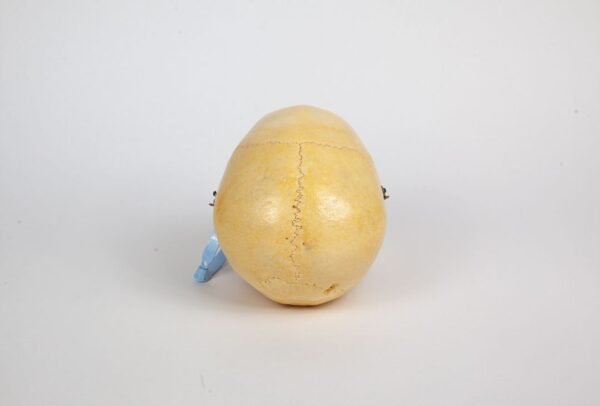Skull with Facial Reconstruction (0249) - Image 4