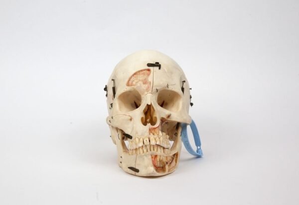 Kilgore Demonstrative Skull (0255)
