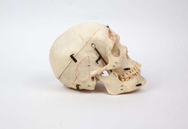 Kilgore Demonstrative Skull (0255) - Image 3