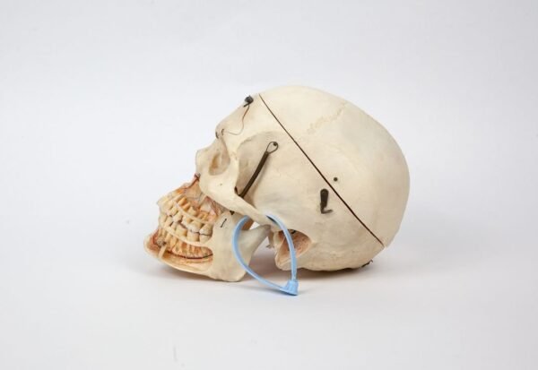 Kilgore Demonstrative Skull (0255) - Image 2